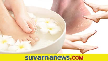 Cracked Heel: ಬಿರುಕು ಬಿಟ್ಟ ಹಿಮ್ಮಡಿಗೆ ಮನೆಯಲ್ಲೇ ಇದೆ ಪರಿಹಾರ