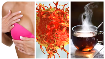 World Cancer Day 2022: Breast implants to hot tea, 7 things that can raise your risk of cancer