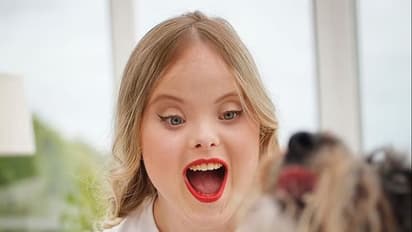 Beth Matthews : ഡൗണ്സ് സിന്ഡ്രോം തോറ്റു, ഗ്ലാമര് ലോകത്ത് താരമായി ഈ യുവതി!