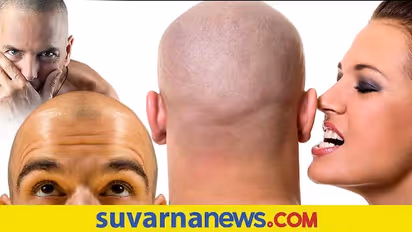 ಬೋಳುತಲೆಯ ಪುರುಷರಲ್ಲಿ ಹೆಚ್ಚು ಕಾಮಾಸಕ್ತಿ ಇರುತ್ತಾ?