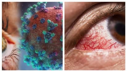 Omicron new symptoms: கண்களை குறிவைத்து தாக்கும் ஒமிக்ரான்...இனி இந்த அறிகுறிகள் இருந்தால் அலெர்ட்டா இருங்கோ!!
