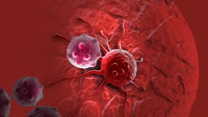 Cancer : ക്യാൻസർ ; ജീവിതശൈലിയിൽ വരുത്തേണ്ട പ്രധാനപ്പെട്ട ചില മാറ്റങ്ങൾ