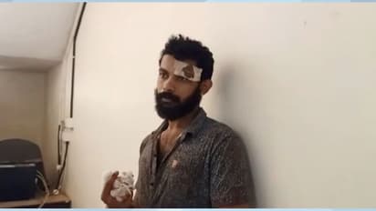 Father attacked : ലഹരിക്ക് അടിമകളായ സഹോദരങ്ങള്‍ അച്ഛന്റെ തലക്ക് അടിച്ചു, ഗുരുതര പരിക്കുമായി അച്ഛൻ ഐസിയുവിൽ