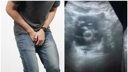 ലിം​ഗത്തിൽ കഠിനമായ വേദന, മൂത്രത്തിൽ രക്തം; ഡോക്ടർമാർ പരിശോധിച്ചപ്പോൾ ഞെട്ടി...