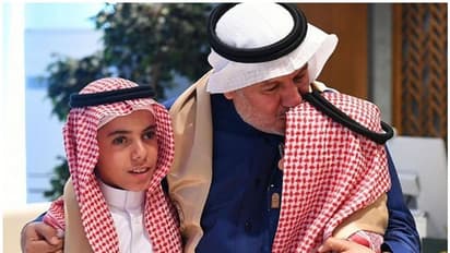 Separated Siamese twins : വേർപെടുത്തിയ ഡോക്ടറെ കാണാൻ പതിമൂന്ന് വർഷത്തിന് ശേഷം സയാമീസ് ഇരട്ടകളെത്തി