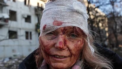 Humans of Ukraine: Scarred, jolted yet resilient (PHOTOS)