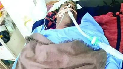 हे भगवान ये कैसी गलती: ICU में भर्ती जिंदा मरीज को मरा समझ हटा दिया वेंटिलेटर, नजारा देख हर किसी के उड़े होश