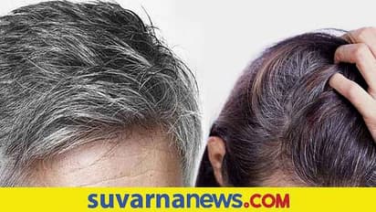 Planets in astrology: ವಯಸ್ಸಿಗೆ ಮುಂಚೆ ಕಾಡ್ತಿರುವ ನಿಮ್ಮ ಬಿಳಿ ಕೂದಲಿನ ಸಮಸ್ಯೆಗೆ ಗ್ರಹ ದೋಷ ಕಾರಣ!