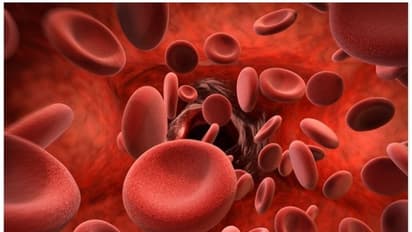 വിളർച്ച അകറ്റുന്നതിന് ഭക്ഷണത്തിൽ ശ്രദ്ധിക്കേണ്ട്...