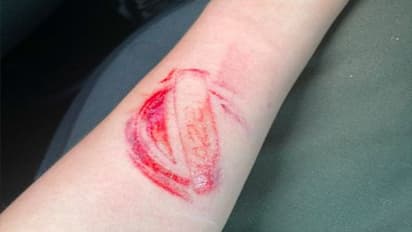 Airbag से बच जाती है जान, लेकिन छोड़ देता कंपनी के लोगो का निशान, देखें दिलचस्प मामले