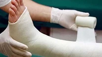 ஜெயிலில் இருந்து வந்ததுமே வேலையை காட்ட ஆரம்பித்த பிரபல ரவுடி.. தடுக்கி விழுந்து கை, கால் முறிவு.!