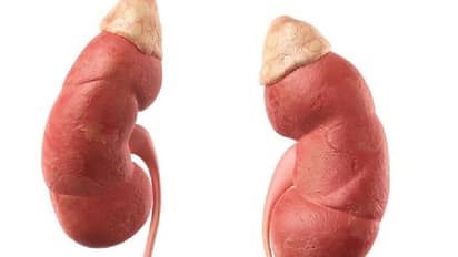 ఢిల్లీలో కిడ్నీ రాకెట్  మఠా గుట్టు రట్టు... డాక్టర్లు సహా 10మంది అరెస్ట్...