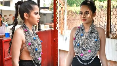 ಟಾಪ್‌ ಬೇಡ ಎಂದೇಳಿ ಚೈನ್ ಧರಿಸಿದ್ದ ನಟಿ Urfi Javed, ಮೈ ತುಂಬಾ ಗಾಯ ಫೋಟೋ ವೈರಲ್!