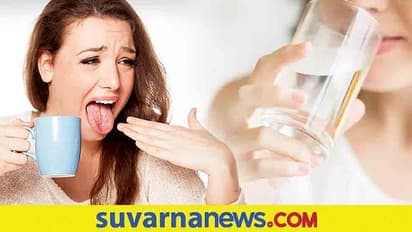 Home Remedy : ಬಿಸಿ ಬಿಸಿ ಟೀ ಕುಡಿದು ನಾಲಿಗೆ ಸುಡ್ತಾ? ಹೀಗ್ಮಾಡಿ..