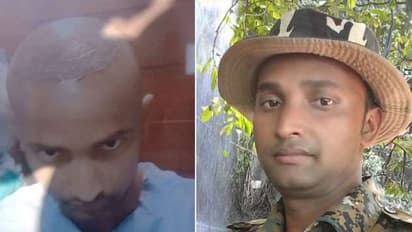 Patna ಮದುವೆ ತಯಾರಿಯಾಗಿ ಕೂದಲು ಕಸಿ ಮಾಡಿಕೊಂಡ, ಮರುದಿನವೇ ಸಾವು ಕಂಡ!