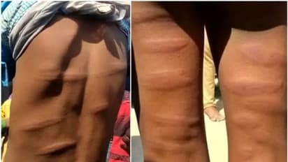 Bihar: ఐదో తరగతి విద్యార్థిపై ఉపాధ్యాయుడి కర్కశత్వం.. బెల్ట్ తో చావుదెబ్బలు కొట్టి.. ఆపై...