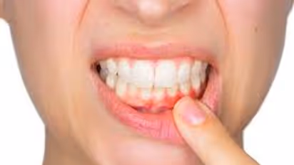 പല്ലില്‍ നിറവ്യത്യാസവും വായ്‍നാറ്റവും ; ഈ മാറ്റങ്ങള്‍ എന്തിന്‍റെ സൂചനയാണ്?