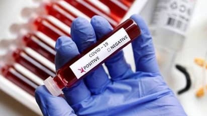 দিল্লির পর এই শহরেও কোভিড-১৯এর কালো ছায়ায়, দৈনিক আক্রান্তের সংখ্যা ভাঙল মার্চের রেকর্ড