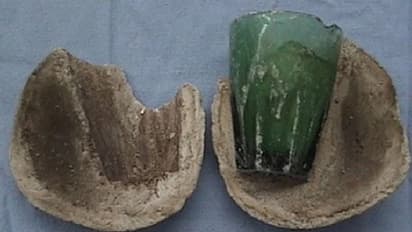 Sex Toy : ചില്ല് ഗ്ലാസ് സെക്‌സ് ടോയ് ആക്കി; മൂത്രാശയത്തില്‍ കുടുങ്ങിക്കിടന്നത് നാല് വര്‍ഷം