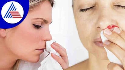 ನಿದ್ದೆ ಮಾಡುವಾಗ ಮೂಗಿನಲ್ಲಿ ರಕ್ತಸ್ರಾವ ಆಗೋಕೆ ಕಾರಣವೇನು ?