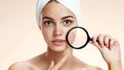 স্যালিসিলিক অ্যাসিড-ত্বকের একাধিক সমস্যা মেটাবে এই একটা মাত্র উপাদান, ট্রাই করতে পারেন