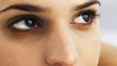 கண்களின் கீழ் தோன்றும் வீக்கம்.. உடனே சரியாக என்ன செய்யணும் தெரியுமா? 