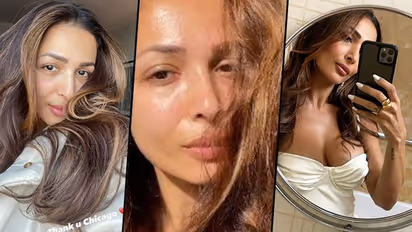 মৃত্যুর মুখ থেকে ফিরে প্রথম পোস্ট মালাইকার, দুর্ঘটনা পর কেমন আছেন বলি ফ্যাশনিস্তা