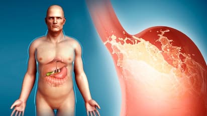 অ্যাসিডিটি থেকে বাঁচার ৫টি আশ্চর্যজনক উপায়, জেনে নিন এই সহজ ঘরোয়া উপায়গুলি