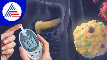 ಕೋವಿಡ್ ಸೋಂಕು ತಗುಲಿತ್ತಾ ? ಟೈಪ್-2 ಮಧುಮೇಹದ ಅಪಾಯ ಹೆಚ್ಚಿದೆ ಹುಷಾರ್ !