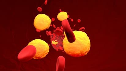 হাই কোলেস্টেরলে ভুগছেন, নিয়ন্ত্রণে আনতে অবশ্যই পাতে রাখুন এই ৭ খাবার