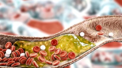 Cholesterol: உடலில் சேரும் கெட்ட கொலஸ்ட்ராலைக் குறைக்க உதவும் சூப்பர் 5 உணவுகள்...மறக்காம ட்ரை  பண்ணுங்கோ..