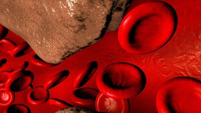 Cholesterol: கொலஸ்ட்ராலை டக்குனு கரைக்க சூப்பர் வீட்டு வைத்தியம்...மிஸ் பண்ணீடாதீங்க...