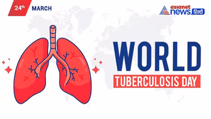 World TB Day 2022: क्या होता है DOTS? जानें सबसे घातक संक्रमण से बचने का  तरीका