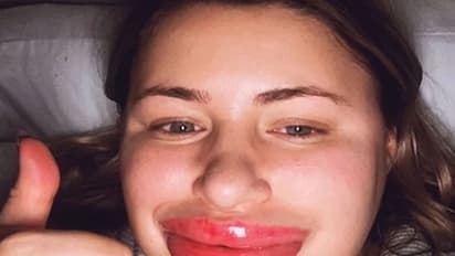 सुंदर दिखने के लिए महिला ने महिला ने किया ऐसा प्रयोग, अब डॉक्टर भी देखकर हैरान