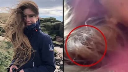 യുവതിയുടെ മുടിയിൽ കൂടുകെട്ടിയ പക്ഷിക്കുഞ്ഞ്!