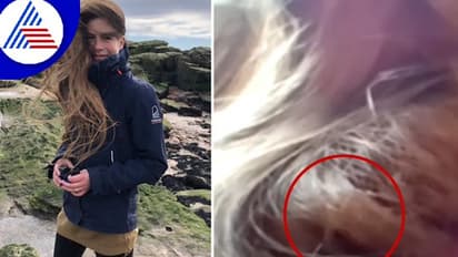 ಬರೋಬ್ಬರಿ 84 ದಿನ ಯುವತಿಯ ಕೂದಲಲ್ಲೇ ಗೂಡು ಕಟ್ಟಿ ವಾಸವಿದ್ದ ಹಕ್ಕಿ..!