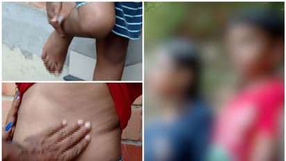 തിരുവനന്തപുരത്ത് പത്ത് വയസുകാരന് ക്രൂര മര്ദ്ദനം; ഡ്രൈവറെ അറസ്റ്റ് ചെയ്ത് ജാമ്യത്തിൽ വിട്ടു