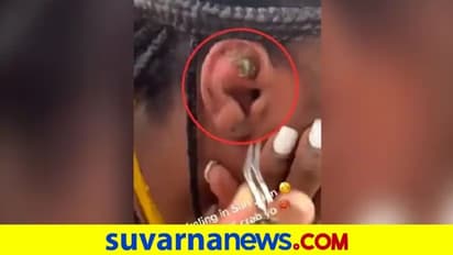 ಮಹಿಳೆಯ ಕಿವಿ ಒಳಗಿಂದ ಹೊರಬಂದ ಏಡಿ ಮರಿ... ವಿಡಿಯೋ ನೋಡಿ