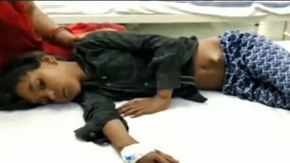 छतरपुर में खेलते-खेलते जमीन पर गिरी मासूम : आठ इंच की लकड़ी पीठ में घुसी, घंटों की मशक्कत के बाद बची जान