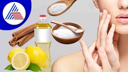 ನೈಸರ್ಗಿಕ ಉತ್ಪನ್ನ ಅಂತ ಕಿಚನ್‌ನಲ್ಲಿ ಸಿಕ್ಕಿದ್ದೆಲ್ಲಾ ಮುಖಕ್ಕೆ ಹಚ್ಬೇಡಿ, ಅಪಾಯ ತಪ್ಪಿದ್ದಲ್ಲ !