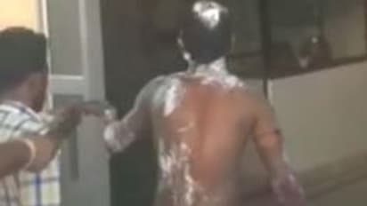 राजस्थान के नागौर में बीवी को लेने ससुराल पहुंचा पति, तू चल नहीं तो यहीं मरूंगा, न सुनते ही खुद को लगा ली आग