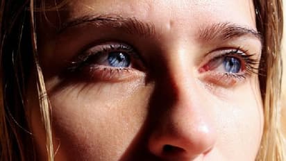 চোখের সমস্যা এড়াতে এই নিয়মগুলো মেনে চলুন, চোখের রোগ হবে না কখনও