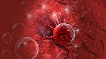 Cancer : വ്യായാമം ചെയ്യുന്നത് ഈ അർബുദം പിടിപെടാനുള്ള സാധ്യത കുറയ്ക്കുന്നു; പഠനം