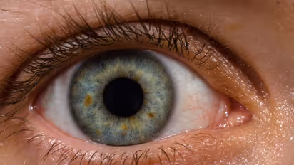 Eye Health: ಕಣ್ಣುಗಳಲ್ಲಿ ಉಂಟಾಗುವ ಈ ಲಕ್ಷಣಗಳನ್ನು ಅಲಕ್ಷಿಸಬೇಡಿ