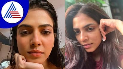 ನಟಿಯರ ತ್ವಚೆ wow ಅಂದುಕೊಳ್ಳಬೇಡಿ; ಮೊಡವೆ ಮುಖದ ಫೋಟೋ ಹಂಚಿಕೊಂಡ ನಟಿ ಮಾಳವಿಕಾ!