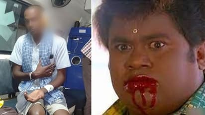 மண் கொட்டியதில் தகராறு.. சண்டை போட்டவரின் காதை கடித்து துப்பிய நபர்.. வைரல் சம்பவம் !!