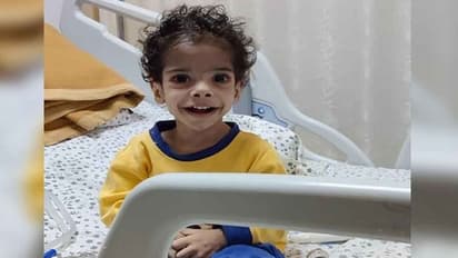 ఈ చిన్నారి మృత్యుంజయుడు.. రెండేళ్ల బాబుకు అరుదైన అన్నవాహిక ఆపరేషన్...