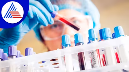 ಬ್ಲಡ್‌ ಟೆಸ್ಟ್ ಮಾಡಿಸೋ ಮೊದಲು ಈ ವಿಚಾರಗಳನ್ನು ತಿಳಿದುಕೊಳ್ಳಿ