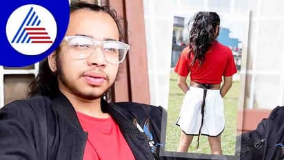 ಕೂದಲುಳ್ಳ ಬಾಲ ಹೊಂದಿರುವ ನೇಪಾಳದ ಹುಡುಗ, 'ಹನುಮಂತನ ಪುನರ್ಜನ್ಮ' ಅಂದ್ರು ಸ್ಥಳೀಯರು!