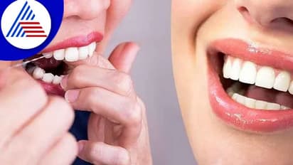 ಹಲ್ಲಿನ ಆರೋಗ್ಯಕ್ಕಾಗಿ ಯಾವ ಆಹಾರ ತಿನ್ನೋದು ಒಳ್ಳೆಯದು ?